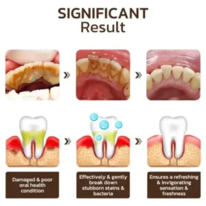 Niacinamide Whitening Toothpaste - Image 5
