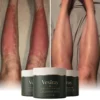 Eczema & Psoriasis Cream