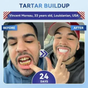 Your Smile~ 🦷 Tideglusib Fast‑Dissolving Tooth & Gum Repair Oral Strips ✨ (𝟓-𝐢𝐧-𝟏 💎 𝐑𝐞𝐛𝐮𝐢𝐥𝐝 𝐄𝐧𝐚𝐦𝐞𝐥 & 𝐃𝐞𝐧𝐭𝐢𝐧 • 𝐒𝐭𝐫𝐞𝐧𝐠𝐭𝐡𝐞𝐧 𝐆𝐮𝐦𝐬 • 𝐄𝐫𝐚𝐝𝐢𝐜𝐚𝐭𝐞 𝐓𝐚𝐫𝐭𝐚𝐫 & 𝐎𝐝𝐨𝐫 • 𝐖𝐡𝐢𝐭𝐞𝐧𝐢𝐧𝐠 • 𝐒𝐭𝐨𝐩 𝐓𝐨𝐨𝐭𝐡 𝐒𝐞𝐧𝐬𝐢𝐭𝐢𝐯𝐢𝐭𝐲) - Image 2