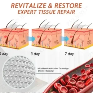 Vein Ease Microneedle Care Patch - Image 11