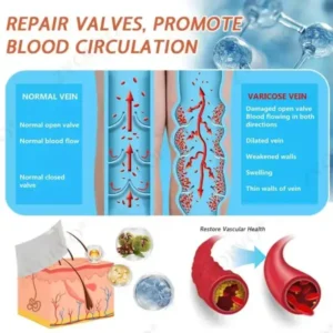 Vein Ease Microneedle Care Patch - Image 3
