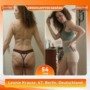 2026 NEUE VERSION 𝐌𝒐𝗋𝐢𝐧𝐠𝒂 & 𝐁𝗲𝗋𝐛𝐞𝐫𝐢𝐧𝐞 4-in-1 Mikropartikel-Shaping & Fettverbrennungs-Shortss - Image 9