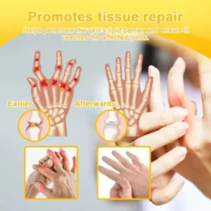 Botulinum Toxin & Bee Venom Pain-Relief Bone Healing Cream - Image 12