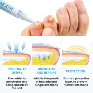 NanoFix Nail Repair Pen 2026 | Healthy Nail Support - Image 5
