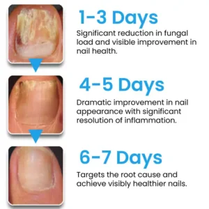 NanoFix Nail Repair Pen 2026 | Healthy Nail Support - Image 6