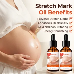 SilkStretch Natural Stretch Mark & Scar Oil - Image 6