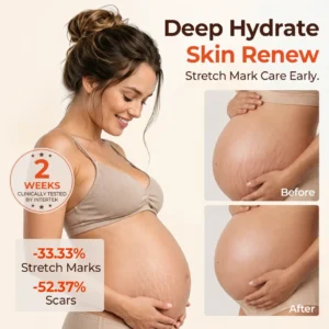 SilkStretch Natural Stretch Mark & Scar Oil - Image 8