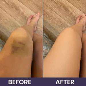 Bruise Repair & Skin-Strengthening Cream - Image 13