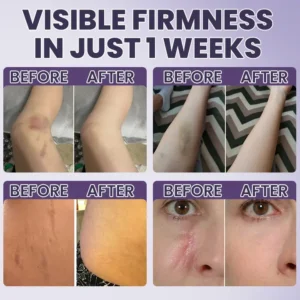 Bruise Repair & Skin-Strengthening Cream - Image 9