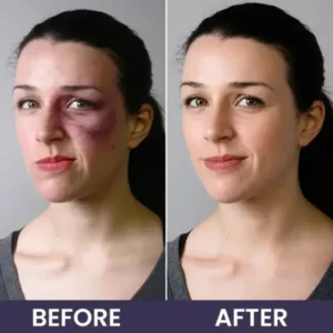Bruise Repair & Skin-Strengthening Cream - Image 15