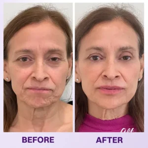 Instant Lift Eye Gel - Image 12