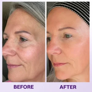 Instant Lift Eye Gel - Image 14