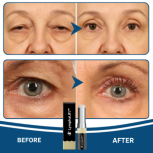 LymphaLift Balm Stick | Cooling Eye Balm - Image 3