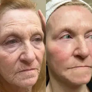 Powerful All-Body Skin Treatment Cream - Image 3