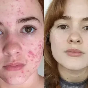 Powerful All-Body Skin Treatment Cream - Image 6