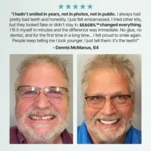 Custom-Fit Full Functional Dentures - Image 3