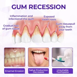 Fluoride Toothpaste - Image 10