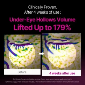 Calcium Eye Cream | Dark Circle Repair - Image 9