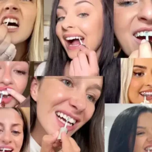 Skavix Tooth Polish | Instant White Smile - Image 8