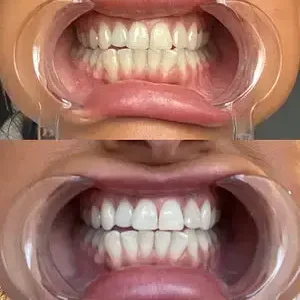Whitening Mouthwash | Fresh Breath - Image 6