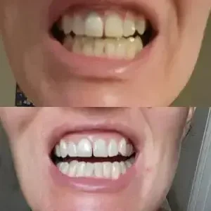Whitening Mouthwash | Fresh Breath - Image 7