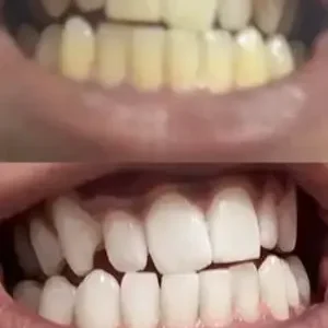 Whitening Mouthwash | Fresh Breath - Image 8