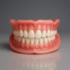 Custom-Fit Functional Dentures