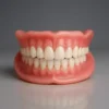 Full Denture