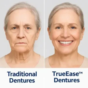 Dentures - Image 5