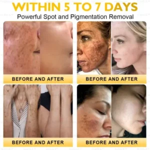 Ultimate All-Body Skin Restoration Cream - Image 5