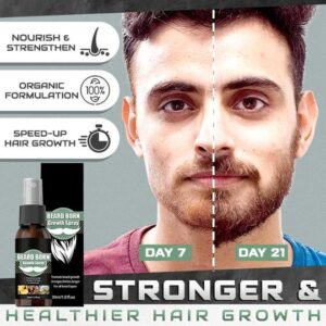BeardBorn Growth Spray - Image 3