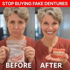 Advanced Functional Dentures - Image 4
