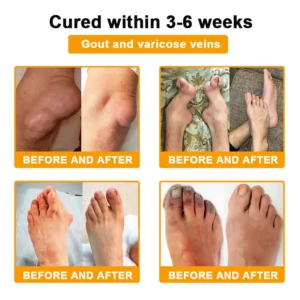 Botulinum & Bee Essence Pain-Relief Bone Healing Cream - Image 11