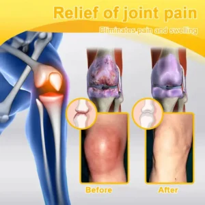 Botulinum & Bee Essence Pain-Relief Bone Healing Cream - Image 12