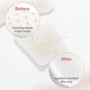 MicroSting Bee Vein Ease Patches - Image 9