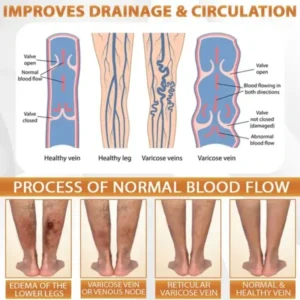 MicroSting Bee Vein Ease Patches - Image 12