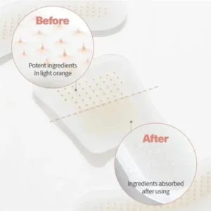 MicroSting Bee Vein Ease Patches - Image 8