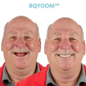 GelFit Dentures - Image 2