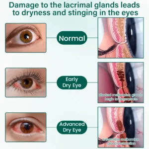 BalanceVie OptiClear Nano Eye Roller Serum - Image 7