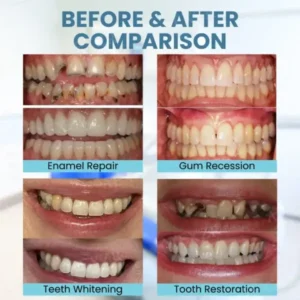 Bee Venom Teeth Restoration Powder - Image 3