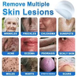 2-in-1 Microneedle + Hydrocolloid Skin Patch Repair System - Image 5
