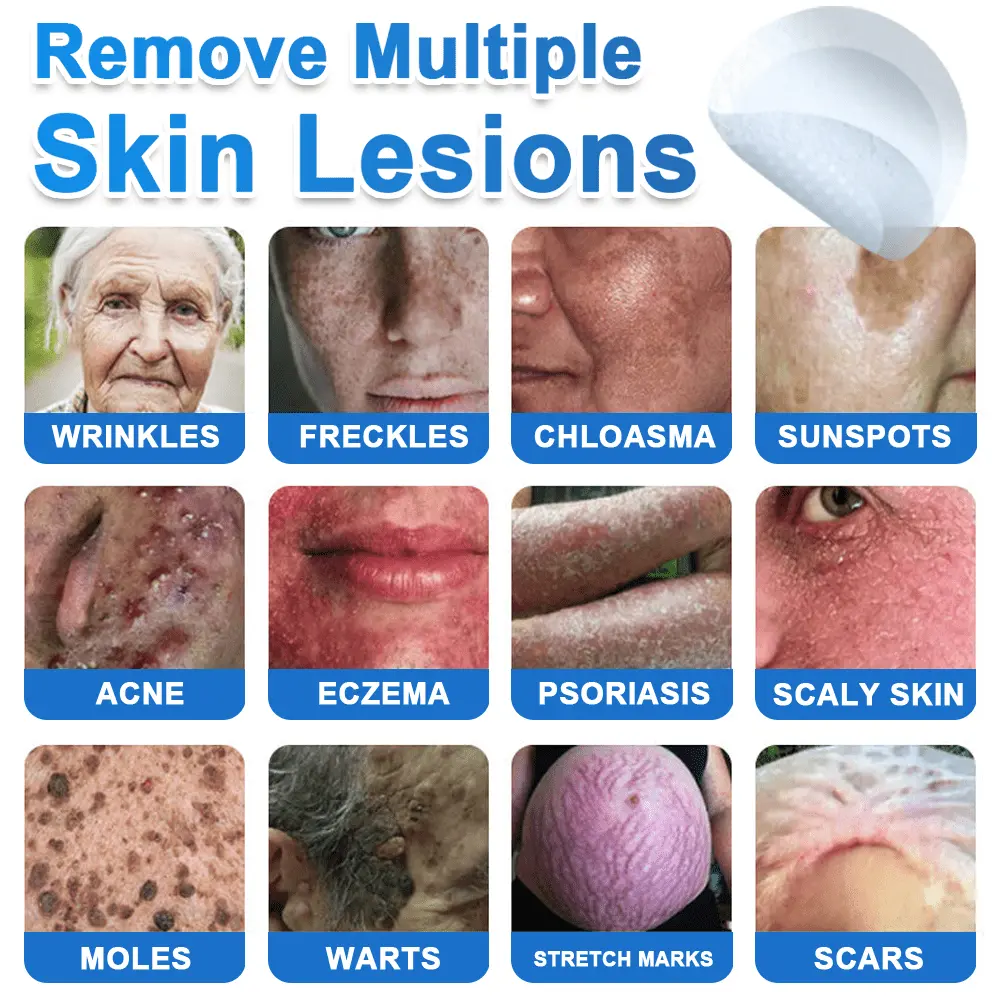 2-in-1 Microneedle + Hydrocolloid Skin Patch Repair System - Image 5