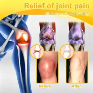 Bellevery Joint & Bone Recovery Patch | Targeted Joint Comfort - Image 12