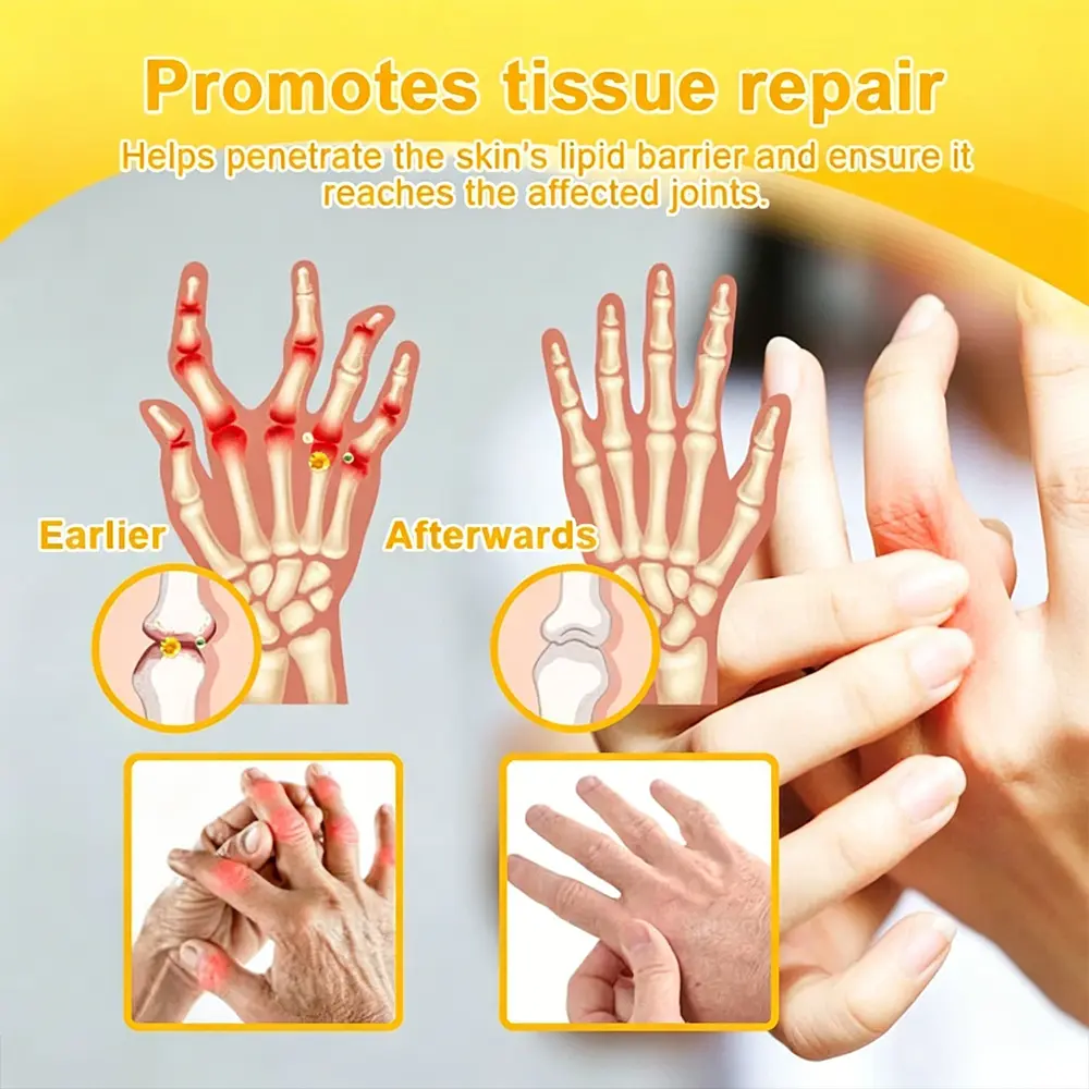 Bellevery Joint Comfort Support Patch - Image 3