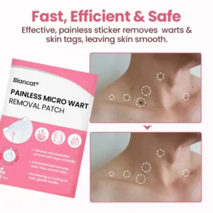 Painless Micro Wart Removal Patch - Image 3