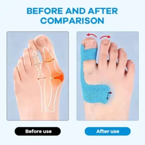 Bunion Relief Toe Correction Wrap - Image 5
