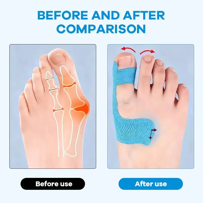 Bunion Relief Toe Correction Wrap - Image 5