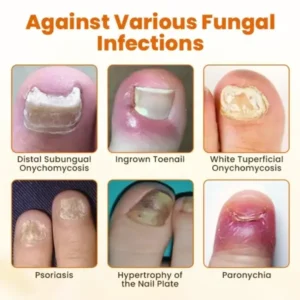 FungiFix Bee Venom Nail Spray - Image 7
