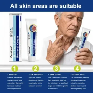 Skin Tag & Wart Removal Cream - Painless At-Home Treatment