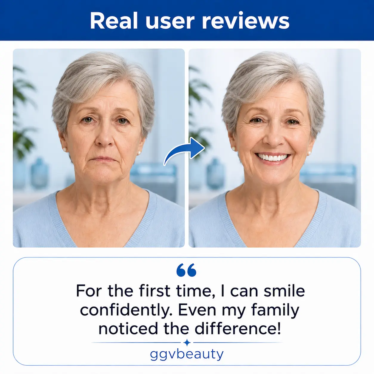 Custom-Fit Dentures | Lightweight At-Home Solution - Image 6